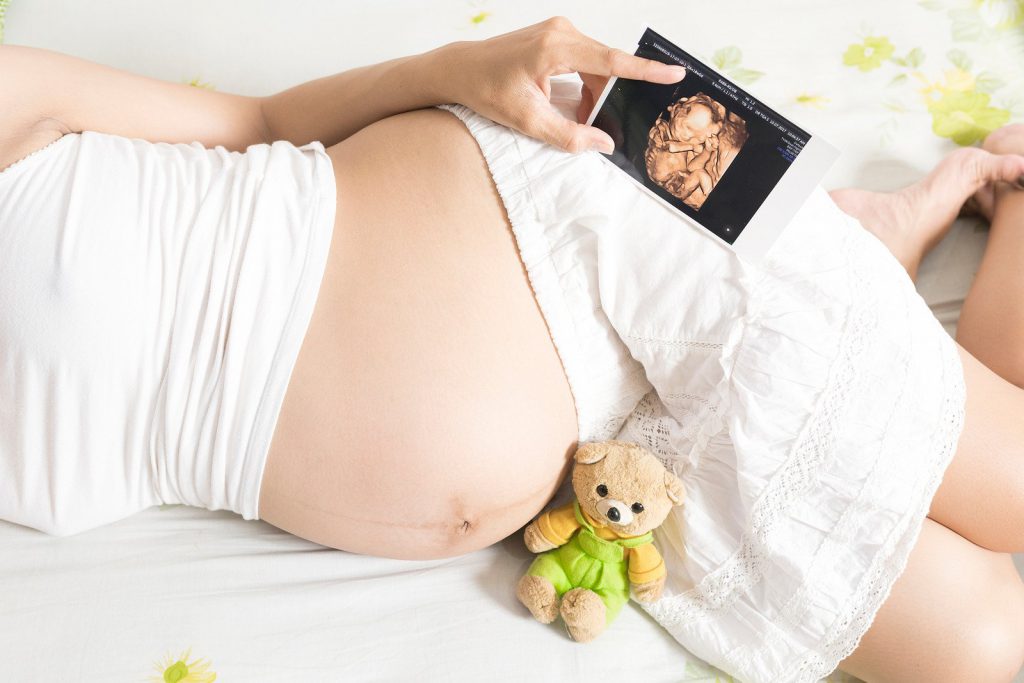 Υπερηχογράφημα 3D / 4D HD Live